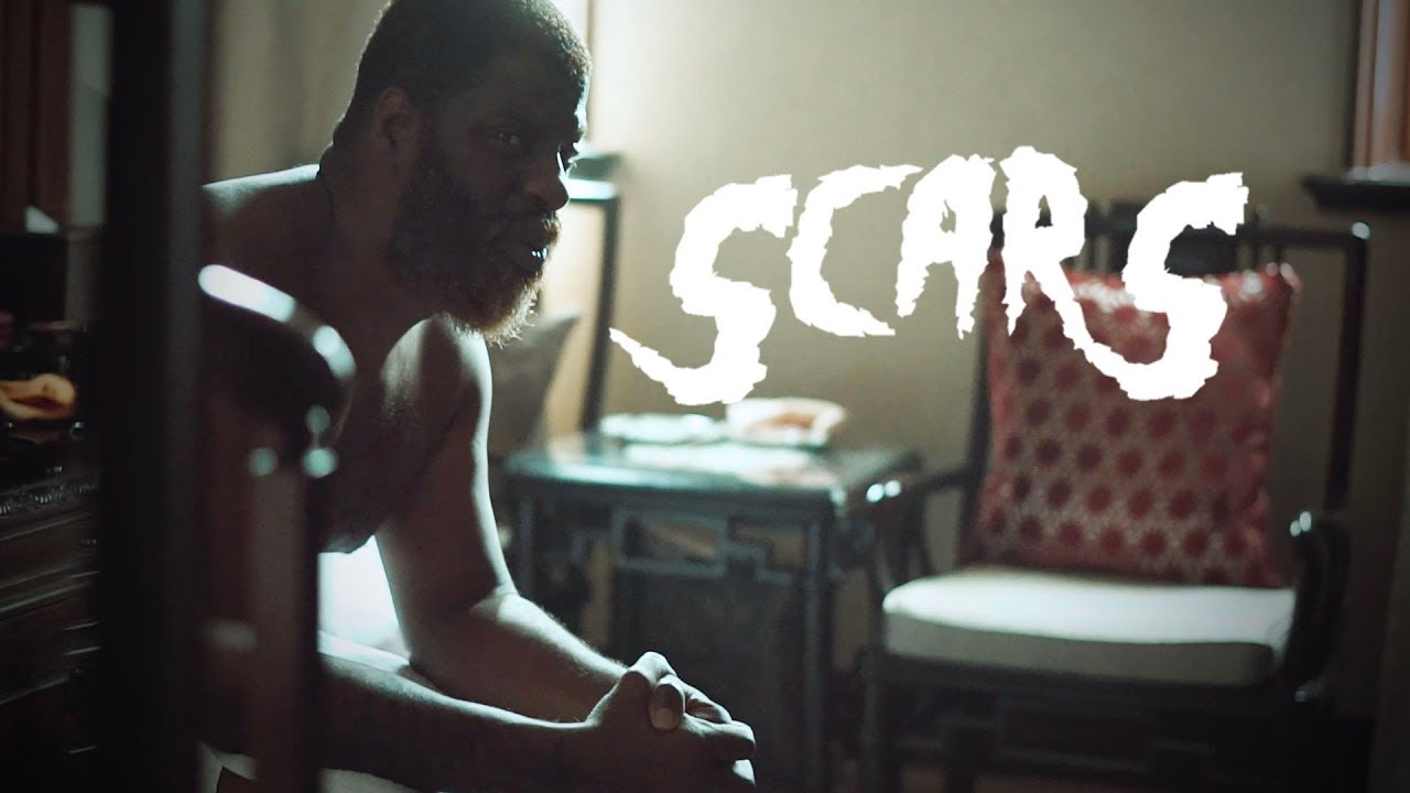Scars