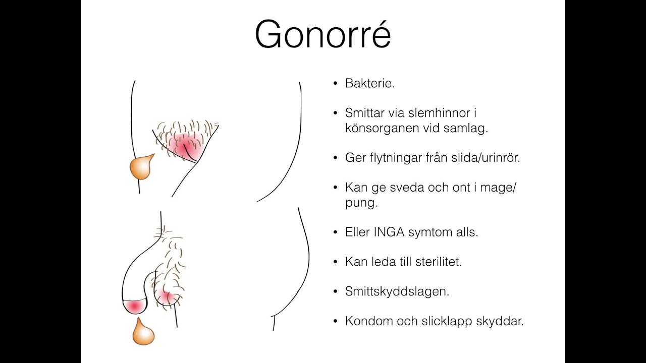 långt hår fnask oralsex i Göteborg långt hår fnask oralsex i Göteborg