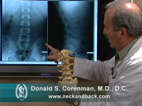 backbone surgery