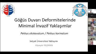 Göğüs Duvarı Deformitelerinde Minimal İnvazif Cerrahi Toplantısı