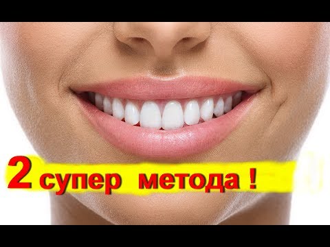Как отбеливать зубы быстро в домашних условиях 205