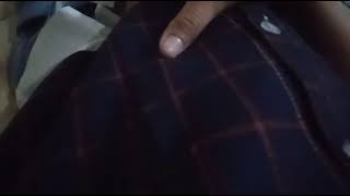 Perut Kembung Terparah Mual Sendawa
