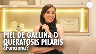 Piel de gallina o Queratosis pilar ¿Como tratarla? Dra Pilar Ochoa - Dermatologa