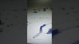 Familia De Demodex Em Citologia De Pustula Integra