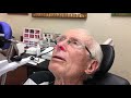 In Office Demonstration of Cryotherapy of the nose