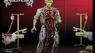 Watch Mortician Drilling For Brains video