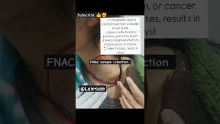 Fnac Fine Needle Aspiration Cytology Explained Fnac