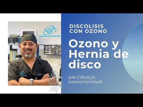 A la vuelta del cuello duele el pecho