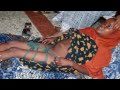 Female Genital Mutilation/Cutting