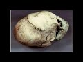 Elongated Conehead Skulls Of Cuzco Peru Ancient Skulls A Mystery images Elongated Conehead Skulls Of Cuzco Peru Ancient Skulls A Mystery