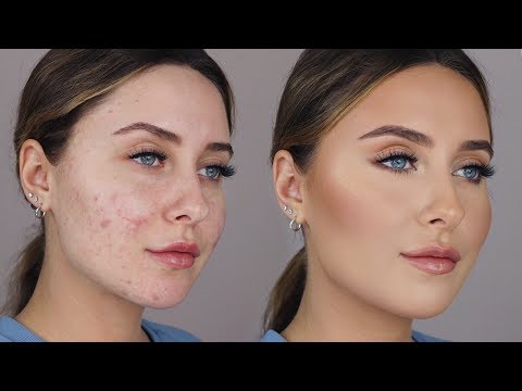 HOW TO COVER ACNE SCARS *easy & non cakey* - YouTube