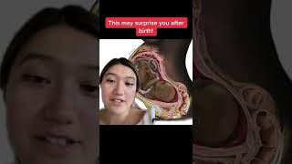 This May Surprise You After Birth