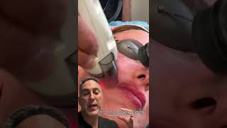 Fraxel Laser For Facial Rejuvenation