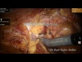 surgery
