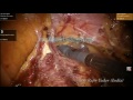 surgery