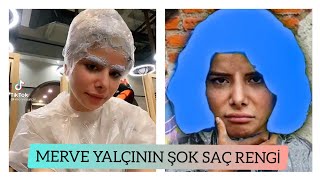 Merve Yalçının Yeni Saç Rengi Çok Şaşıracaksınız