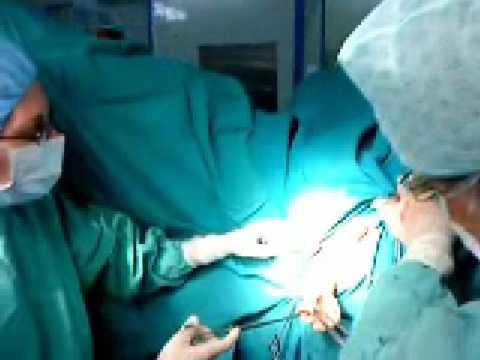 Doctor remove dildo rectum