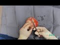 Capsulectomy Procedure - The Park Clinic for Plastic Surgery