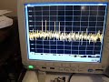 Transient EMI Debug using Tektronix MDO4000 Mixed Domain Oscilloscope