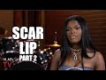 Scar Lip on Her Aunt Allowing Her Boyfriend to D*** & M***** Her When She Was 12 (Part 2)