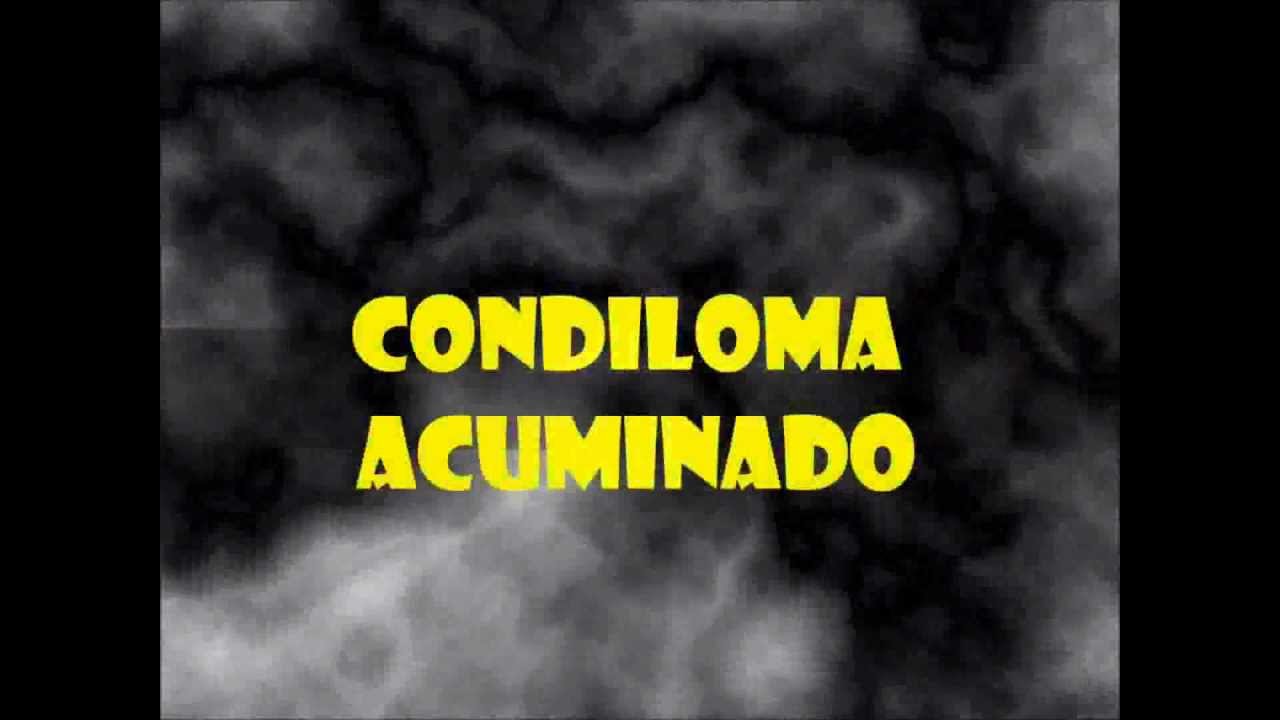 Papa Roach - Metamorphosis Papa Roach - Metamorphosis