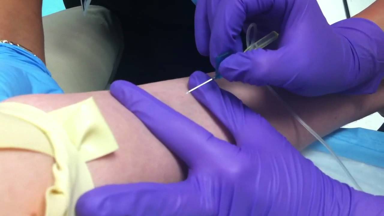 Cassidy hitting Haley�s rolling vein. YouTube