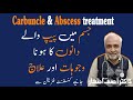 Jism Par Bar Bar Dano Ka Nikalna | Phansi Phoro Ka Ilaj | Abscess Treatment  | Skin Boils Treatment