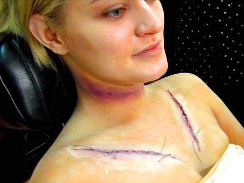 CHICK GETS STITCHES!!!