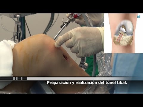 VIDEOS OPERACION videos operacion: