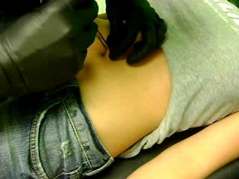 migrated navel piercing. Belly Button Piercing