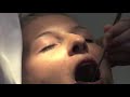 dental fetish