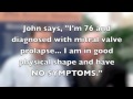 Dr. David Adams Discusses Mitral Valve Repair Surgery For Asymptomatic Patients Mitral Regurgiation