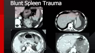 Abdominal Trauma - Dr. Hani Sami