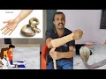 सांप ने काट लिया, अब क्या करें..? सर्पदंश का सही इलाज Snake bite first aid and treatment