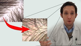 No me lavo el pelo en 1 semana y pasa esto