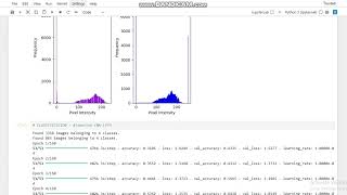 Deep Attention Cnn Lstm For Histopathological Bladder Cancer Detection