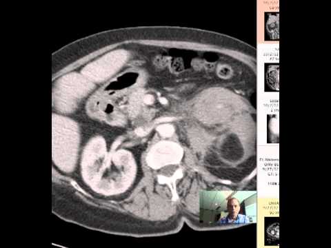 CT Abdomen and Pelvis anatomy DISCUSSION - YouTube