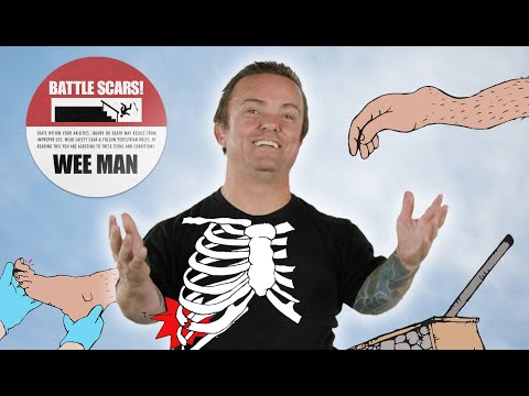 The Worst Injuries Of Wee Man's Career | Battle Scars