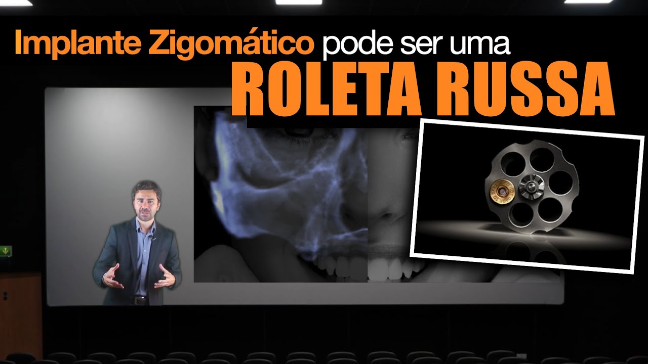 A ROLETA RUSSA DO IMPLANTE ZIGOMÁTICO