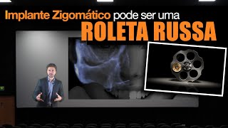 A ROLETA RUSSA DO IMPLANTE ZIGOMÁTICO