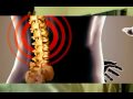 Diathermy - Bipolar diathermy Diathermy - Bipolar diathermy