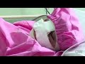 Afghan woman's nose cut off