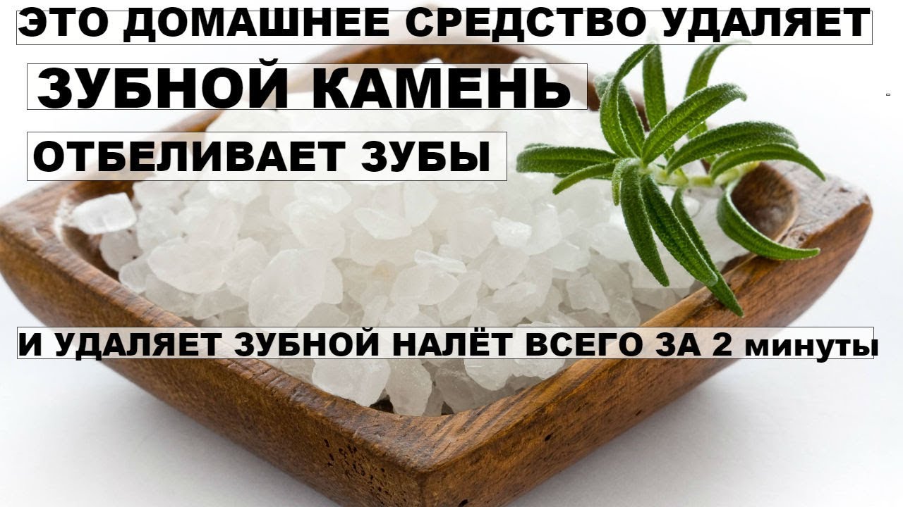 Народная средства от зубных камней в домашних условиях 490