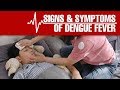 What are the Signs and Symptoms of Dengue Fever?