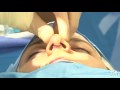 Rhinoplasty or nose job using open technique