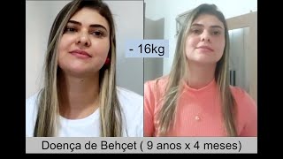 Amanda - Doença de Behçet (Vasculite autoimune)