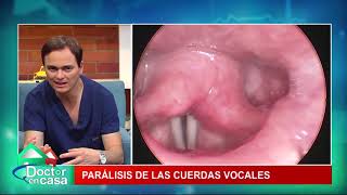 Parálisis de cuerdas vocales
