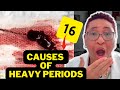 The Shocking Reality of Heavy Period Flow: 16 Potential Causes