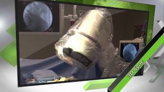 Mazor Robotics Step 3 - 3D Sync