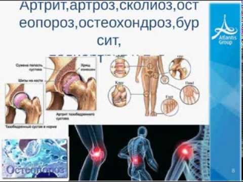 Лечение тазобедренного сустава гомеопатия Лечение тазобедренного сустава гомеопатия
